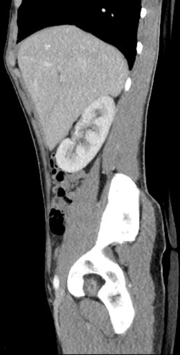 Schwarze und weiße MRT-Aufnahme eines Kniegelenks, die detaillierte Anatomie zeigt.