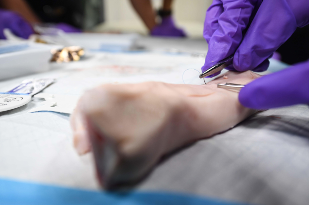 Eine Person in lila Handschuhen hält eine Schere und führt eine Akupunkturbehandlung an einem Patientenschenkel durch, mit verschiedenen Gegenständen auf dem Tisch davor und einem unscharfen Hintergrund.